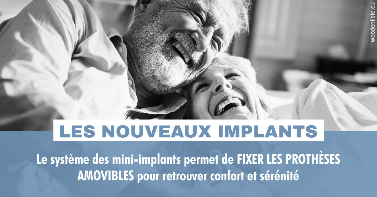 https://dr-dussere-lm.chirurgiens-dentistes.fr/Les nouveaux implants 2