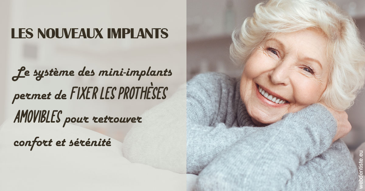 https://dr-dussere-lm.chirurgiens-dentistes.fr/Les nouveaux implants 1