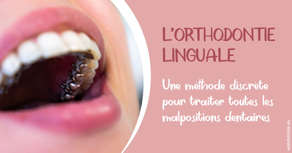 https://dr-dussere-lm.chirurgiens-dentistes.fr/L'orthodontie linguale 2
