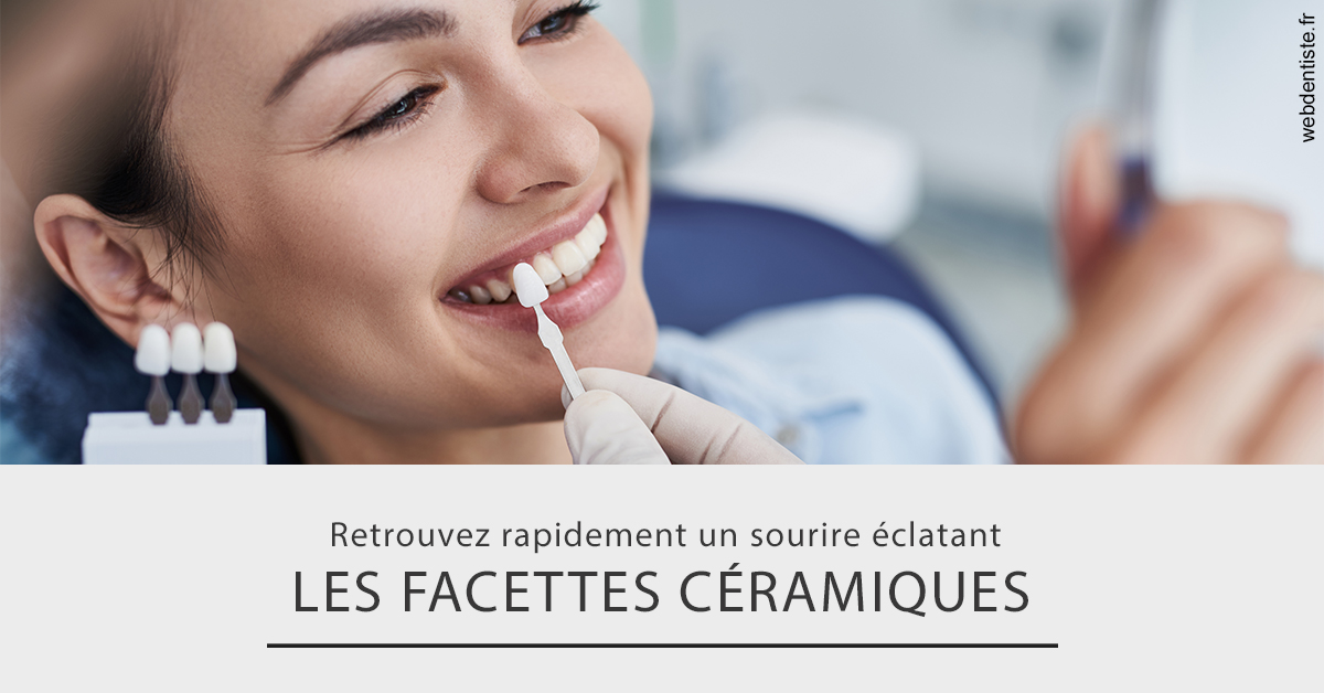 https://dr-dussere-lm.chirurgiens-dentistes.fr/Les facettes céramiques 2