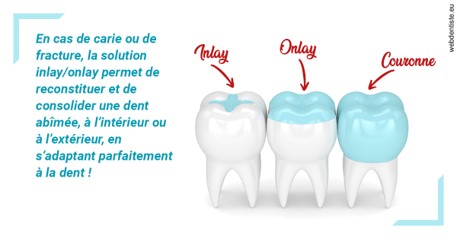 https://dr-dussere-lm.chirurgiens-dentistes.fr/L'INLAY ou l'ONLAY