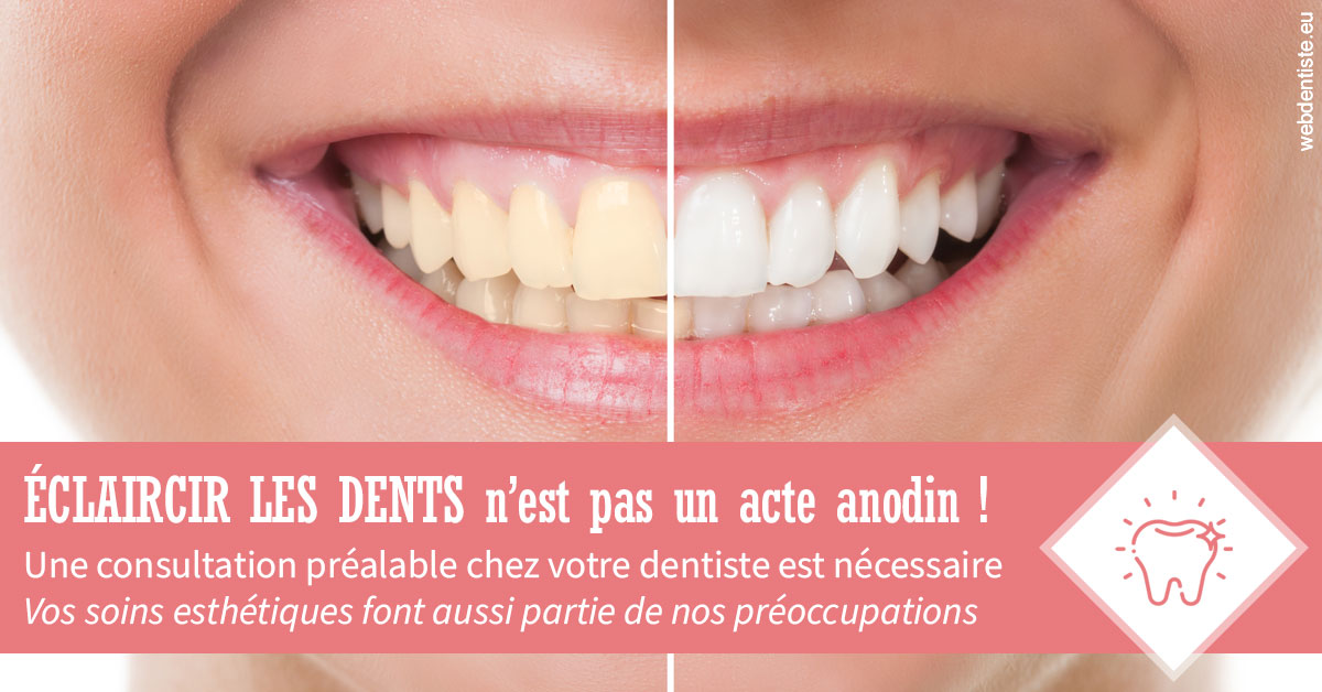 https://dr-dussere-lm.chirurgiens-dentistes.fr/Eclaircir les dents 1