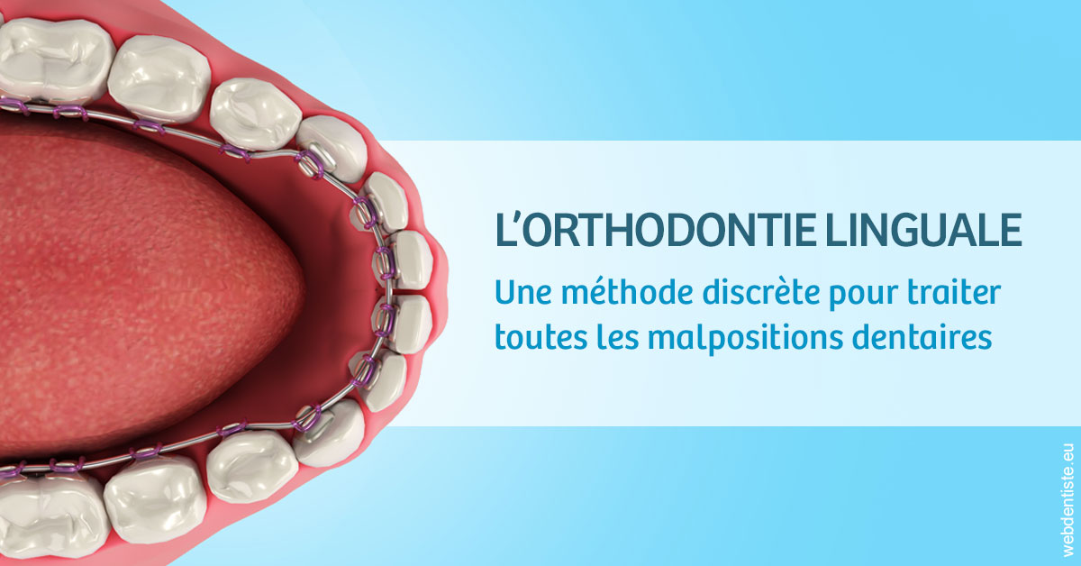 https://dr-dussere-lm.chirurgiens-dentistes.fr/L'orthodontie linguale 1