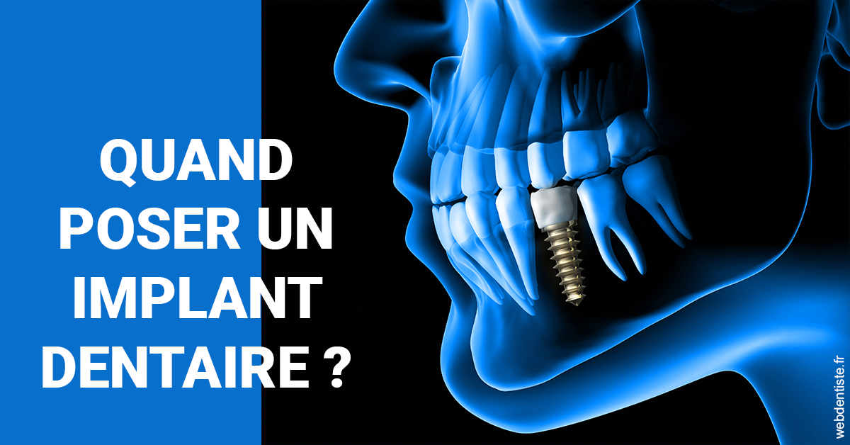 https://dr-dussere-lm.chirurgiens-dentistes.fr/Les implants 1