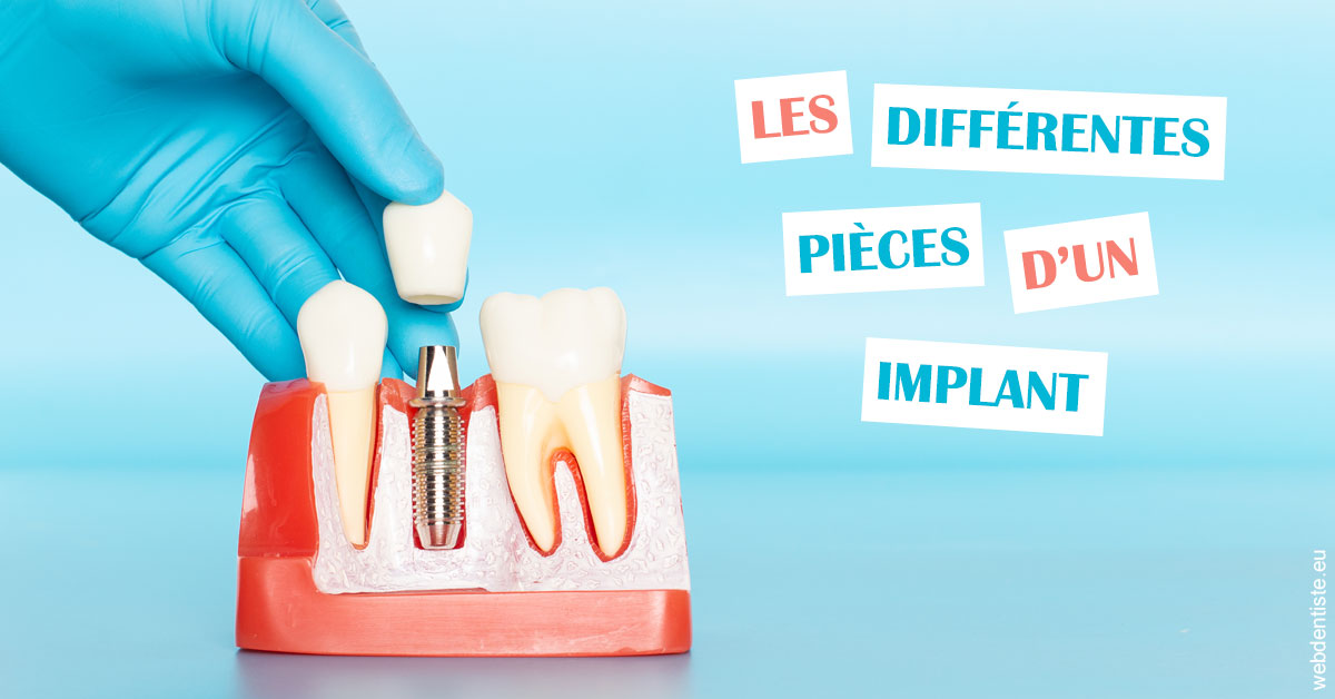 https://dr-dussere-lm.chirurgiens-dentistes.fr/Les différentes pièces d’un implant 2
