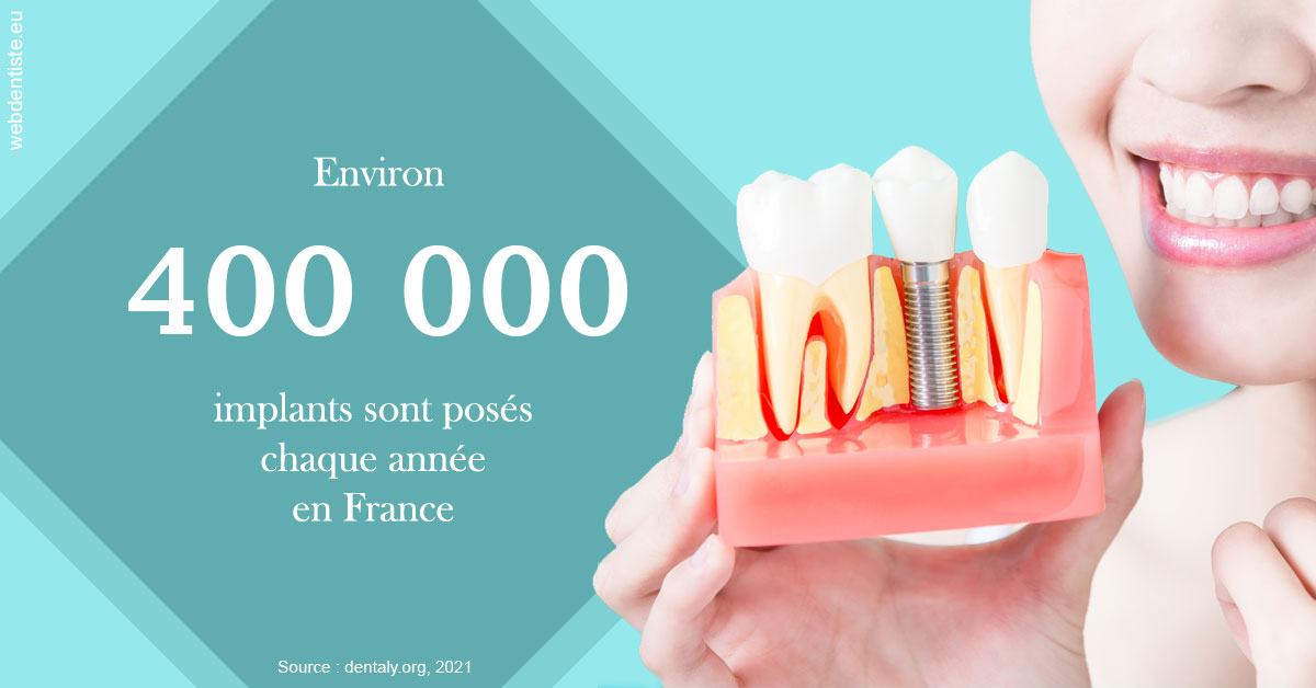 https://dr-dussere-lm.chirurgiens-dentistes.fr/Pose d'implants en France 2