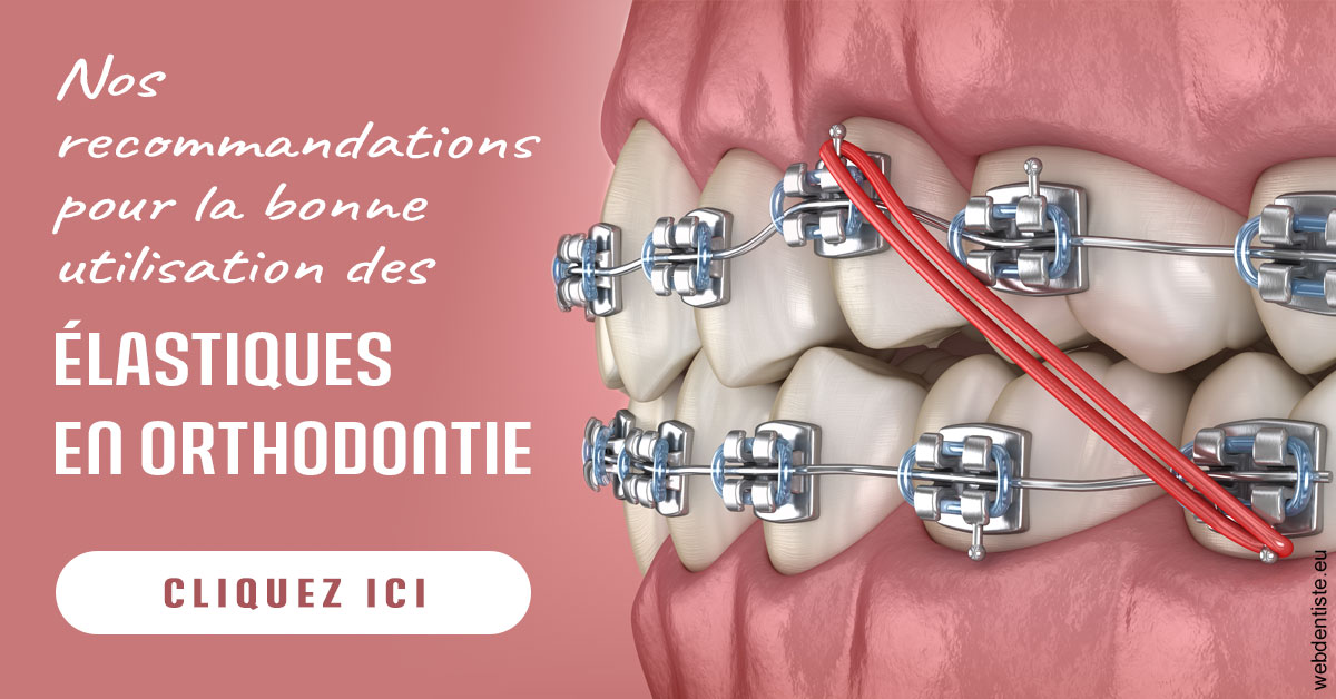 https://dr-dussere-lm.chirurgiens-dentistes.fr/Elastiques orthodontie 2